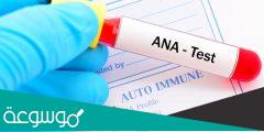 تعرف ما هو تحليل ana