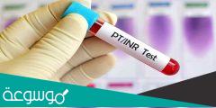 تعرف ما هو تحليل inr
