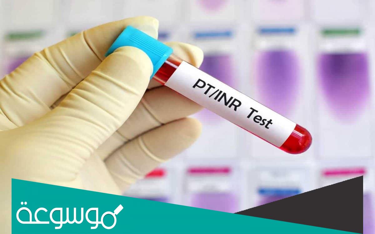 تعرف ما هو تحليل inr