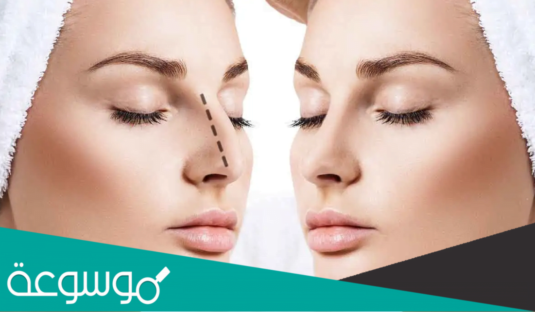 كم تكلفة عملية تجميل الأنف بالخيوط في دبي