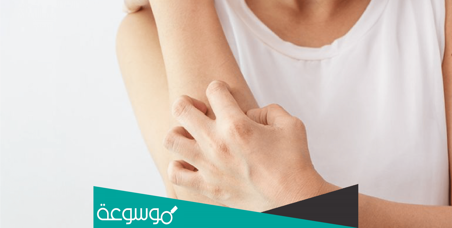 ما هو العلاج النهائي للارتكاريا علاج الارتكاريا الحكة الشديدة مجرب