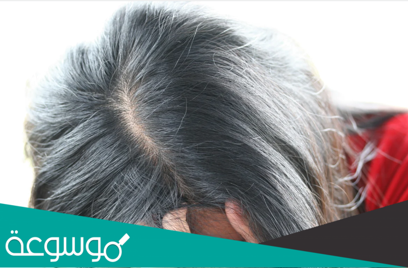 افضل صبغة للشيب جابر القحطاني وعلاج الشيب