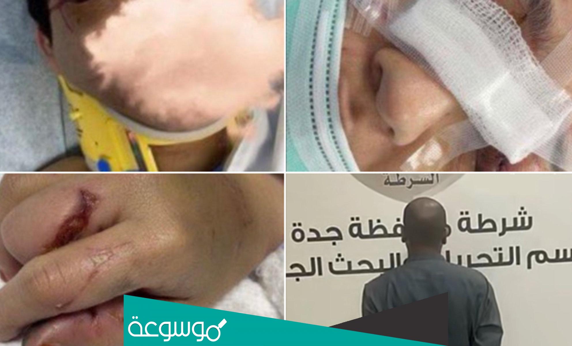 تفاصيل الاعتداء المروع على زوجة في جدة اليوم