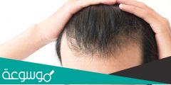 طرق واسعار زراعة الشعر في تركيا وما هي افضل الفنادق واسعارها