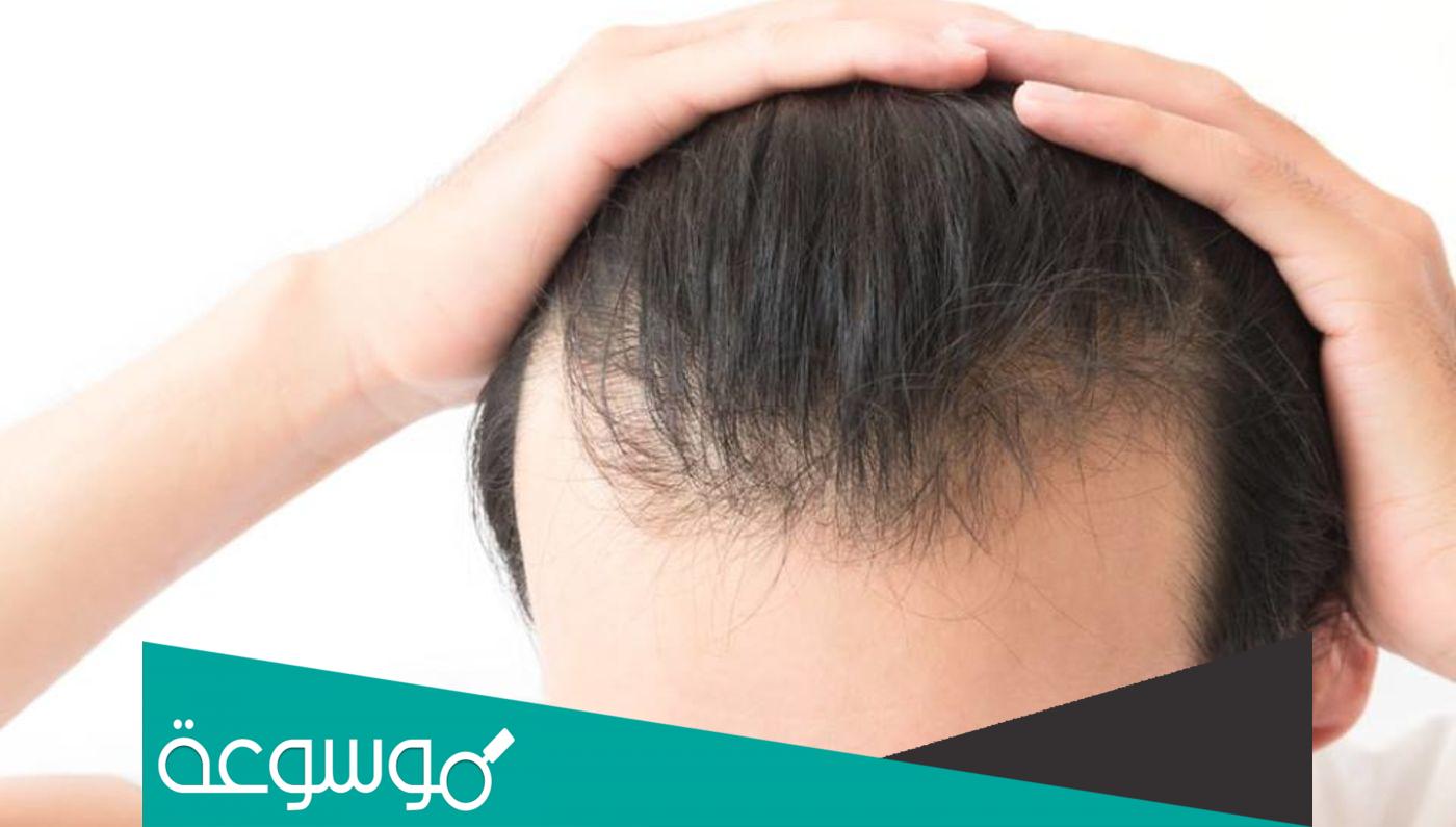 طرق واسعار زراعة الشعر في تركيا