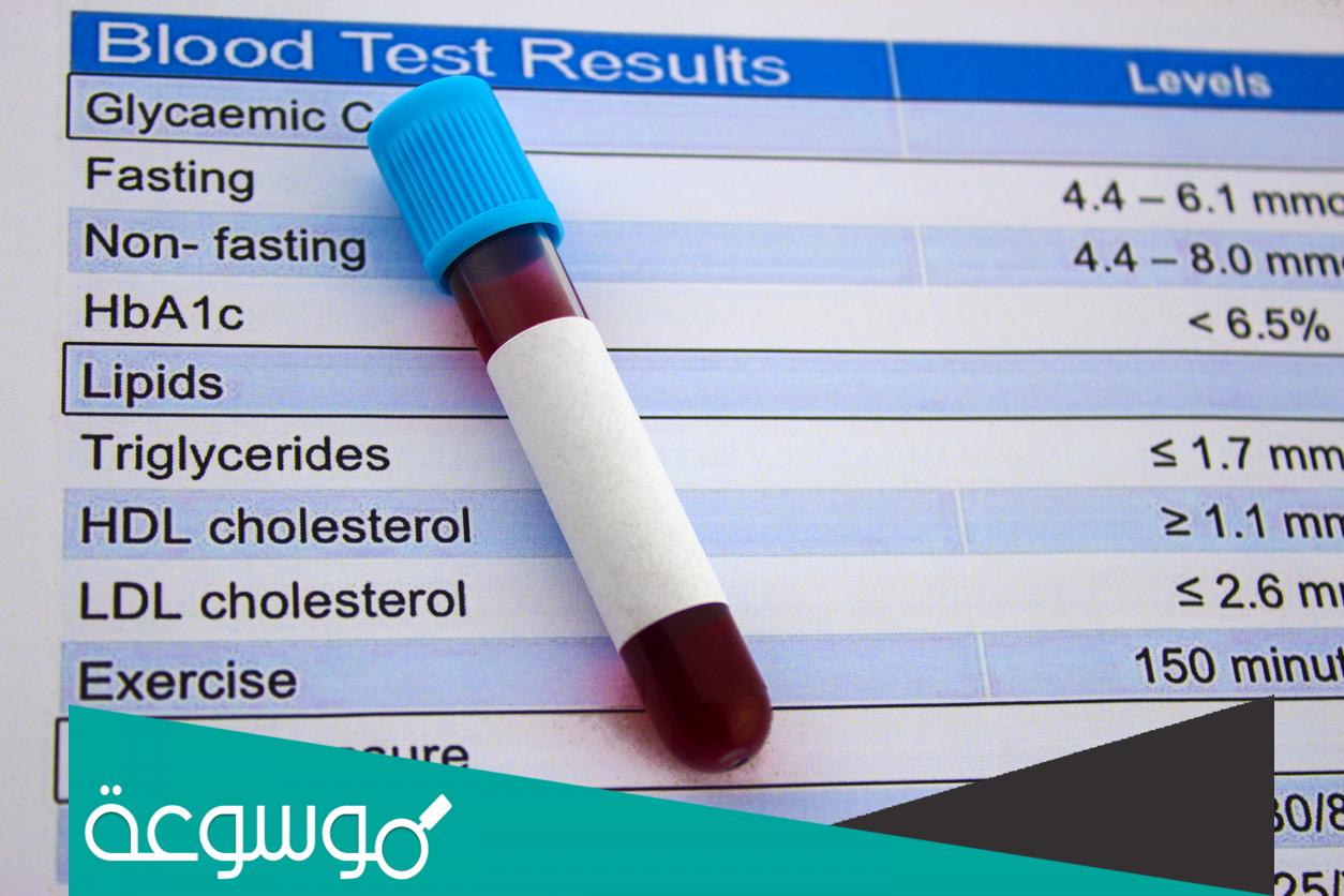 ما هو تحليل ldl cholesterol