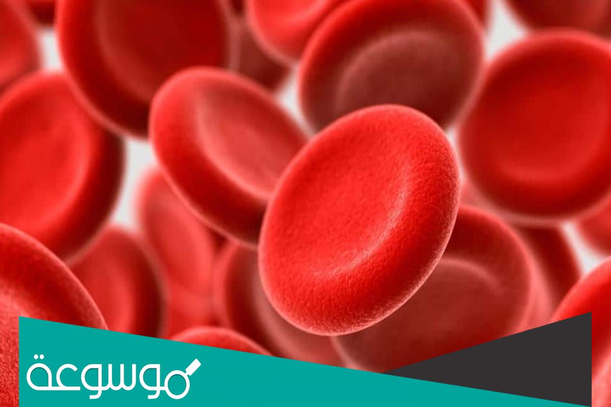 ما هو مرض الهيموفيليا الذي يصيب الرجال