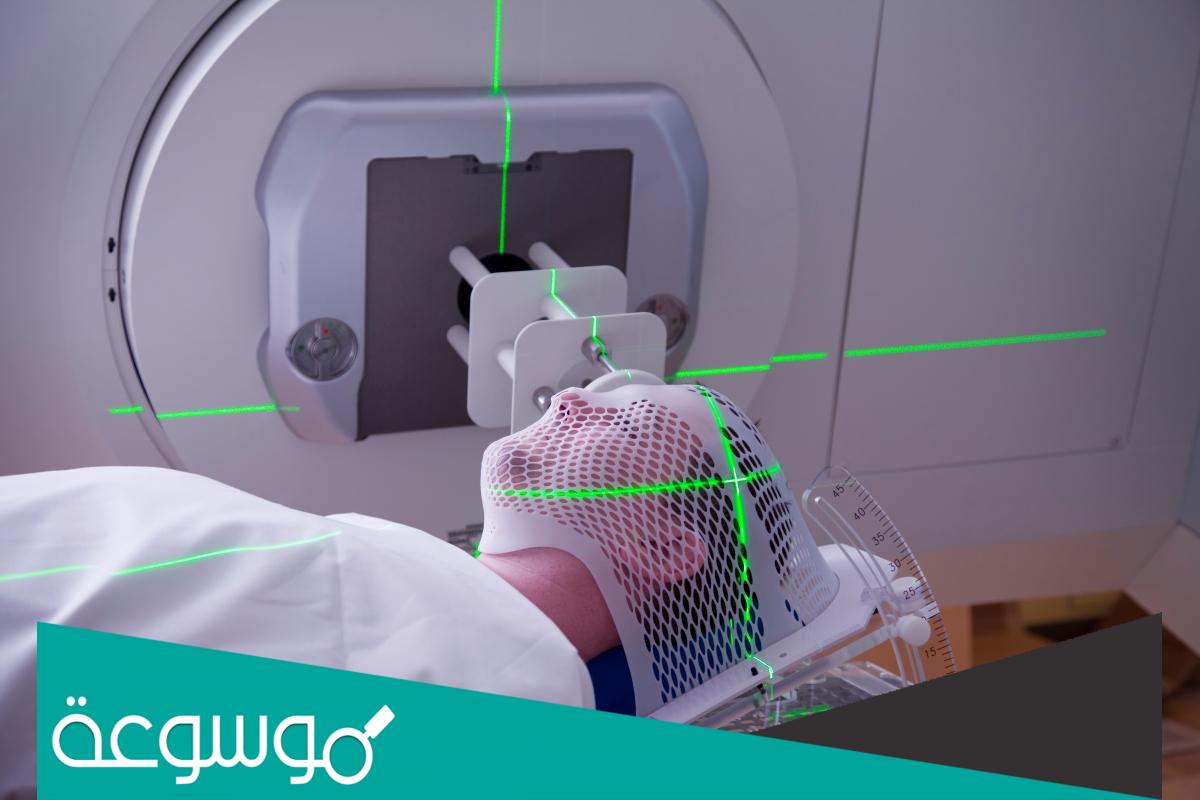 تجربتي مع العلاج الإشعاعي