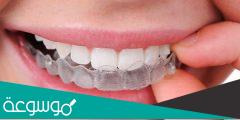 تقويم الاسنان الشفاف | الأنواع والتكلفة والتجارب