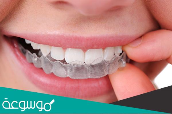 تقويم الاسنان الشفاف | الأنواع والتكلفة والتجارب