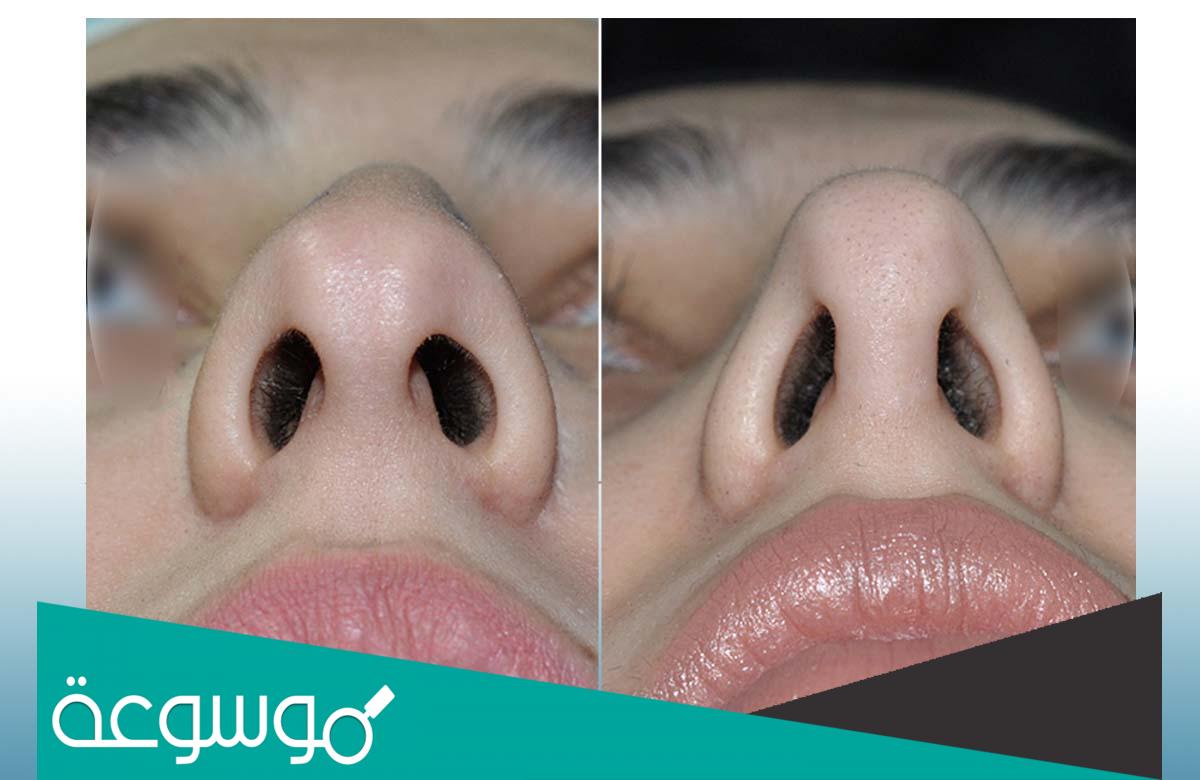 شكل الانف الطبيعي من الداخل