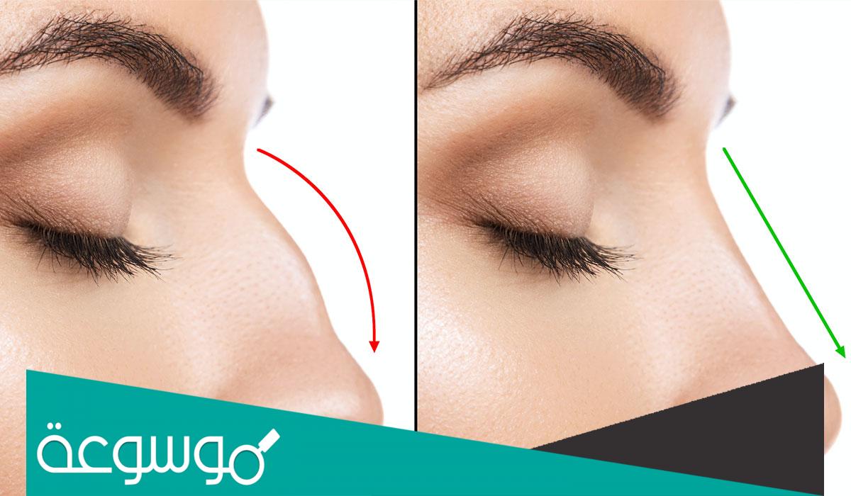 كم سعر عملية تجميل الأنف في السعودية الأسعار والأطباء