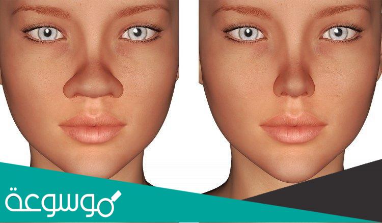 كم سعر عملية تجميل الانف في جدة 2022 | العيادات والتكلفة