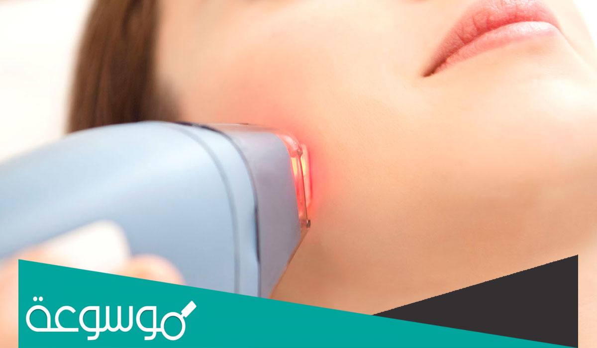كم يتكلف عمل الليزر للجسم بالكامل لإزالة الشعر؟