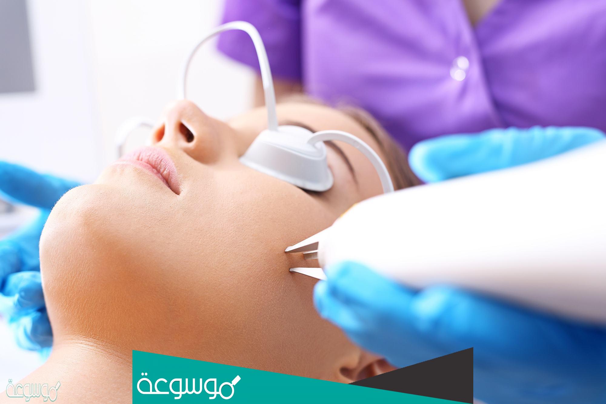 ما هو الشعر الوبري .. كيفية التخلص من الشعر الوبري