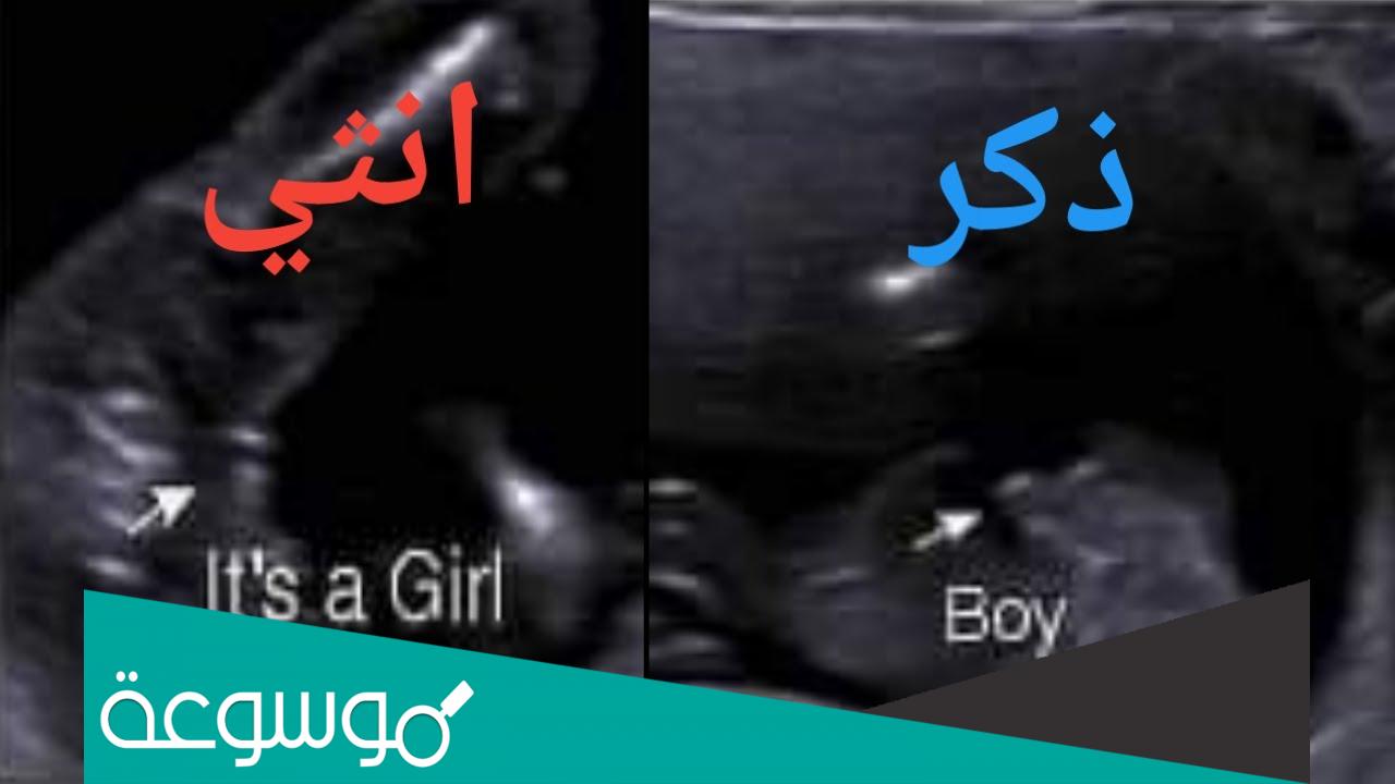 ما الفرق بين الولد والبنت في السونار