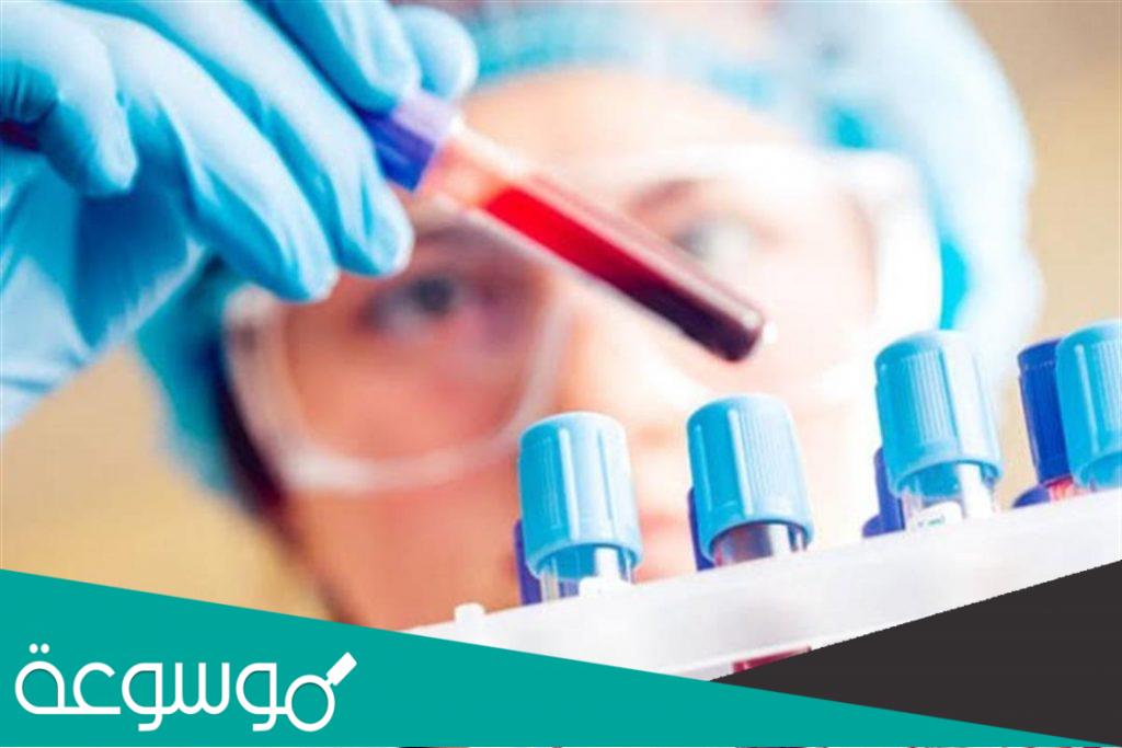 ما هو تحليل mchc وما اسباب واعراض ارتفاعه وانخفاضه