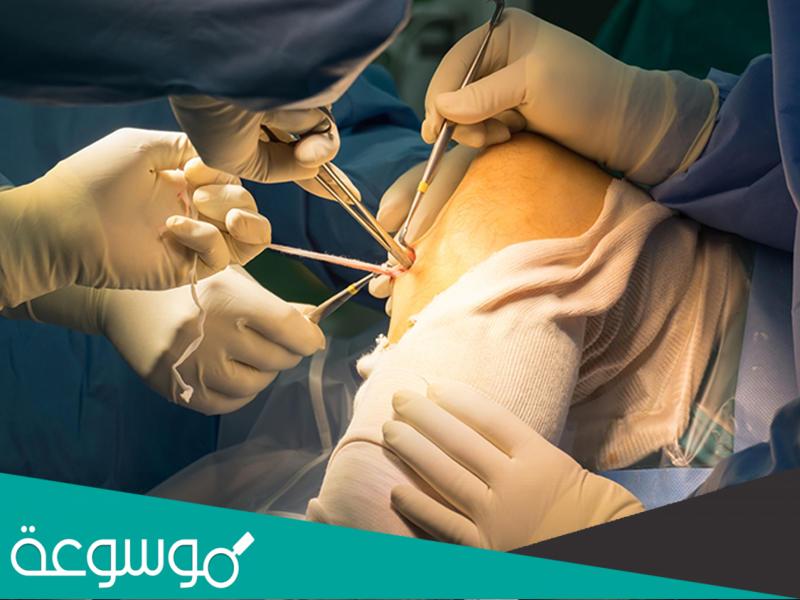 الدكتور مثنى السرطاوي تكلفة عملية استبدال مفصل الركبة