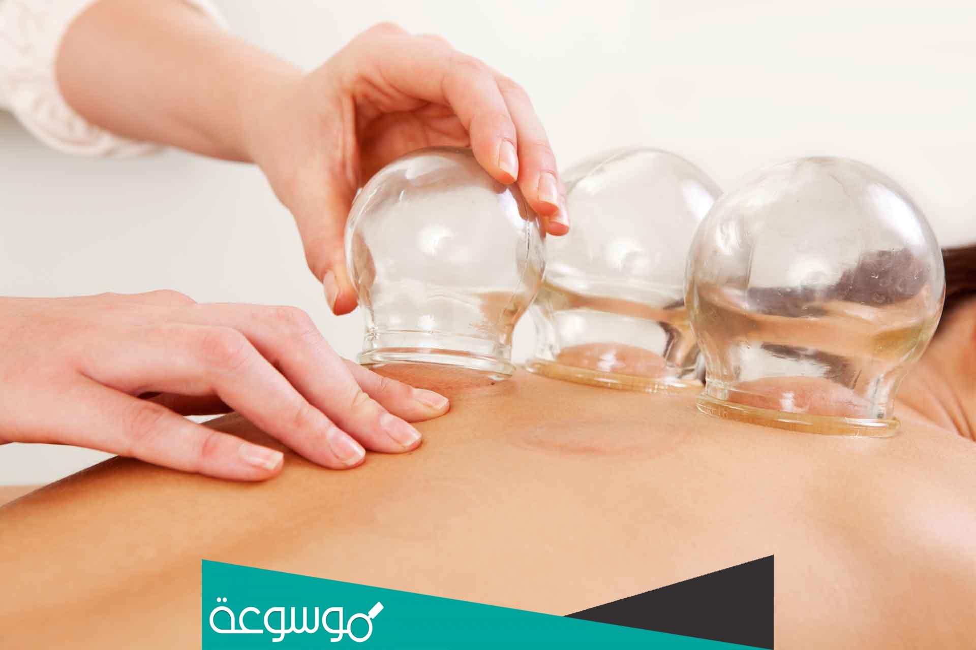 النوم بعد الحجامة بكم ساعة ؟