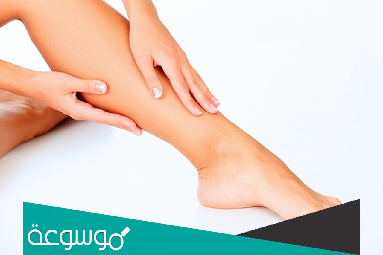 تجربتي مع الحجامة للدوالي