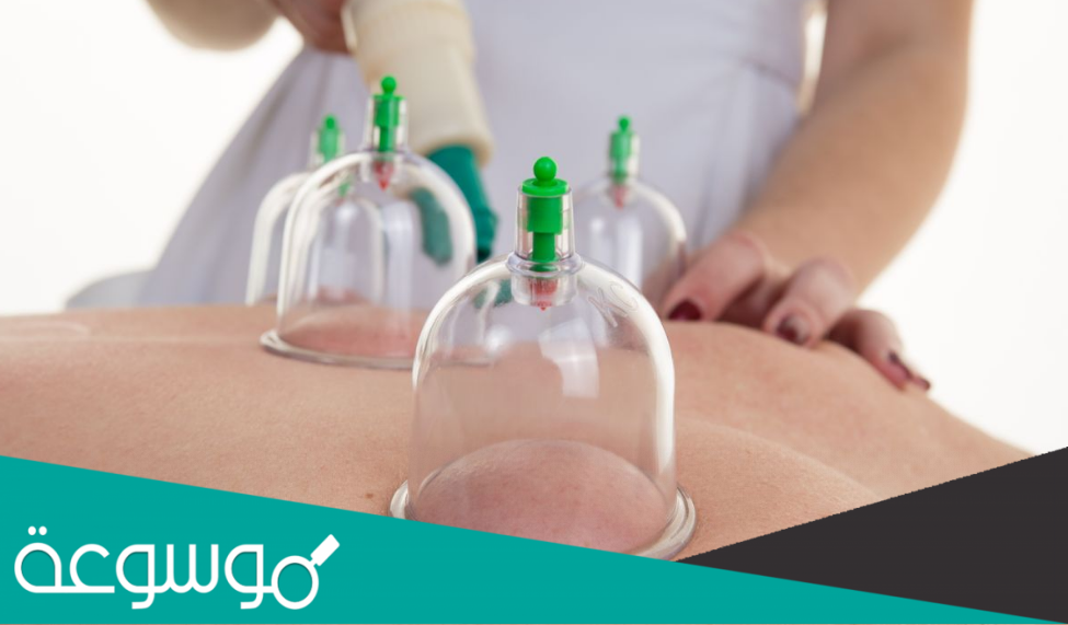 تجربتي مع الحجامة للوسواس مضمونه