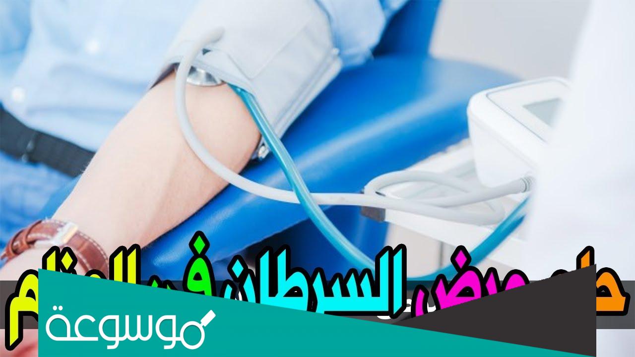 تفسير رؤية مرض السرطان