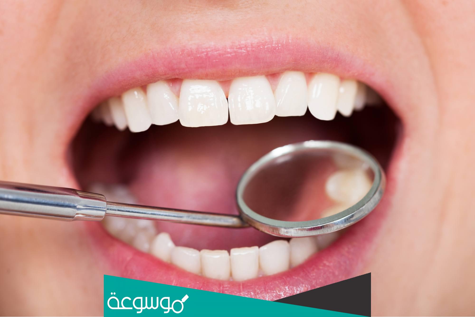 تكلفة عملية تلبيس الاسنان الامامية | تيجان واطقم متحركة