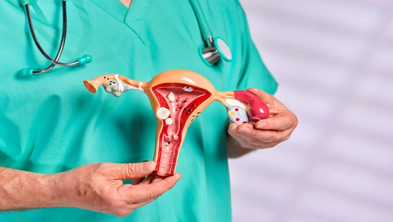 حالات شفيت من بطانة الرحم المهاجرة