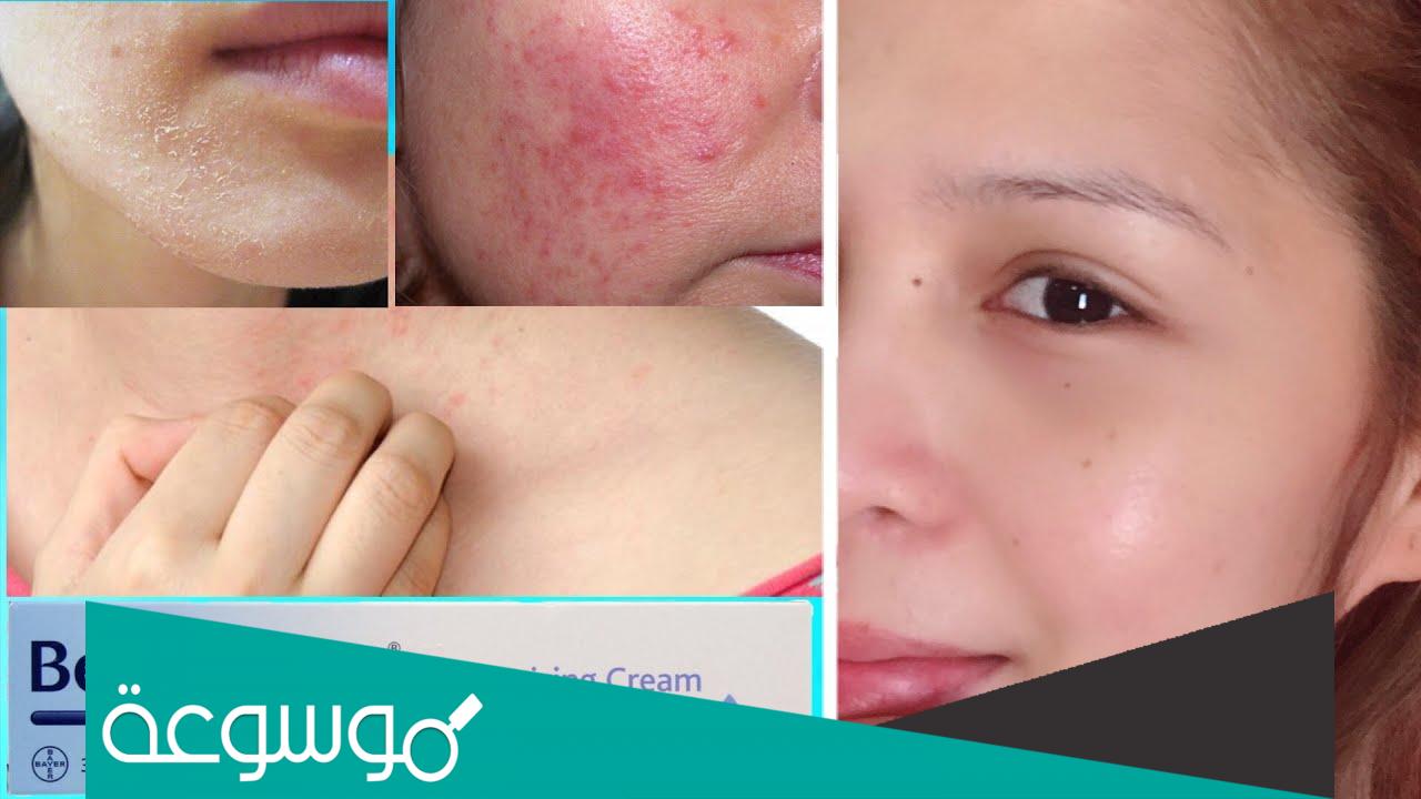 فوائد كريم بيبانثين الوردي للوجه