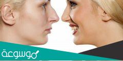كم تكلفة عملية تجميل الأنف | الطريقة و النتائج و المخاطر