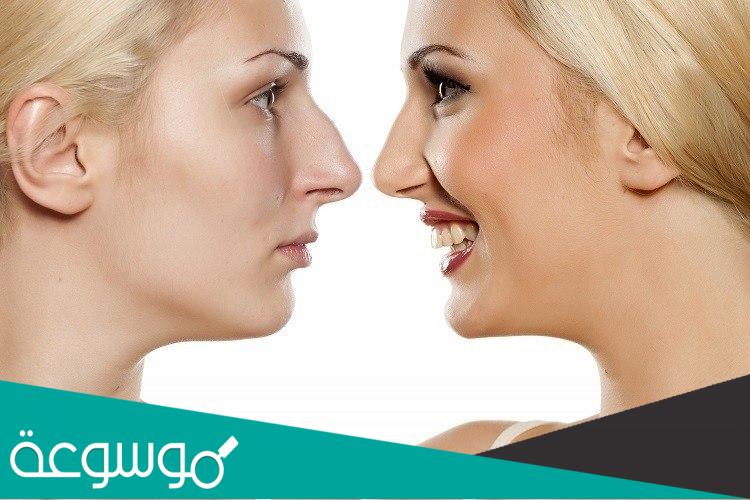 كم تكلفة عملية تجميل الأنف | الطريقة و النتائج و المخاطر