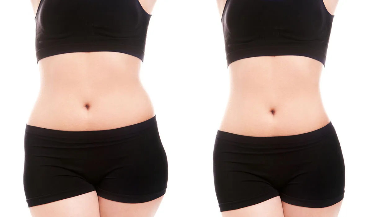 كم تكلفة عملية نحت الجسم