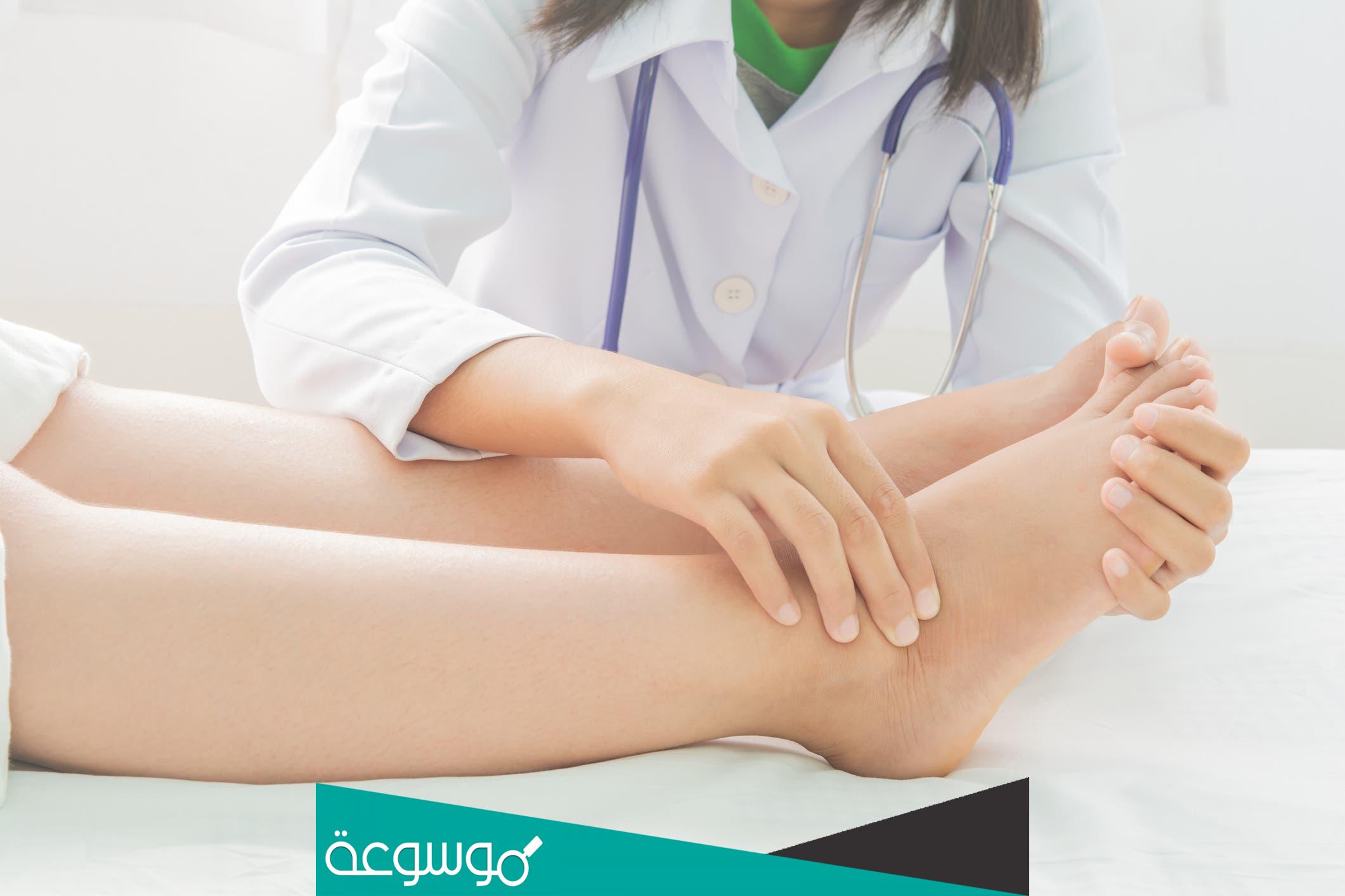 كيفية علاج تورم القدمين بعد السقوط الحر