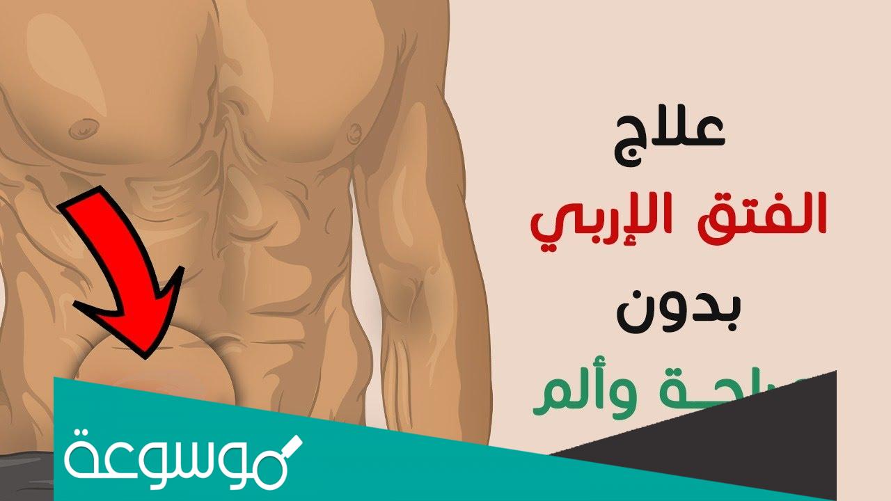 ما هو الفتق الاربي وكيفية علاجه