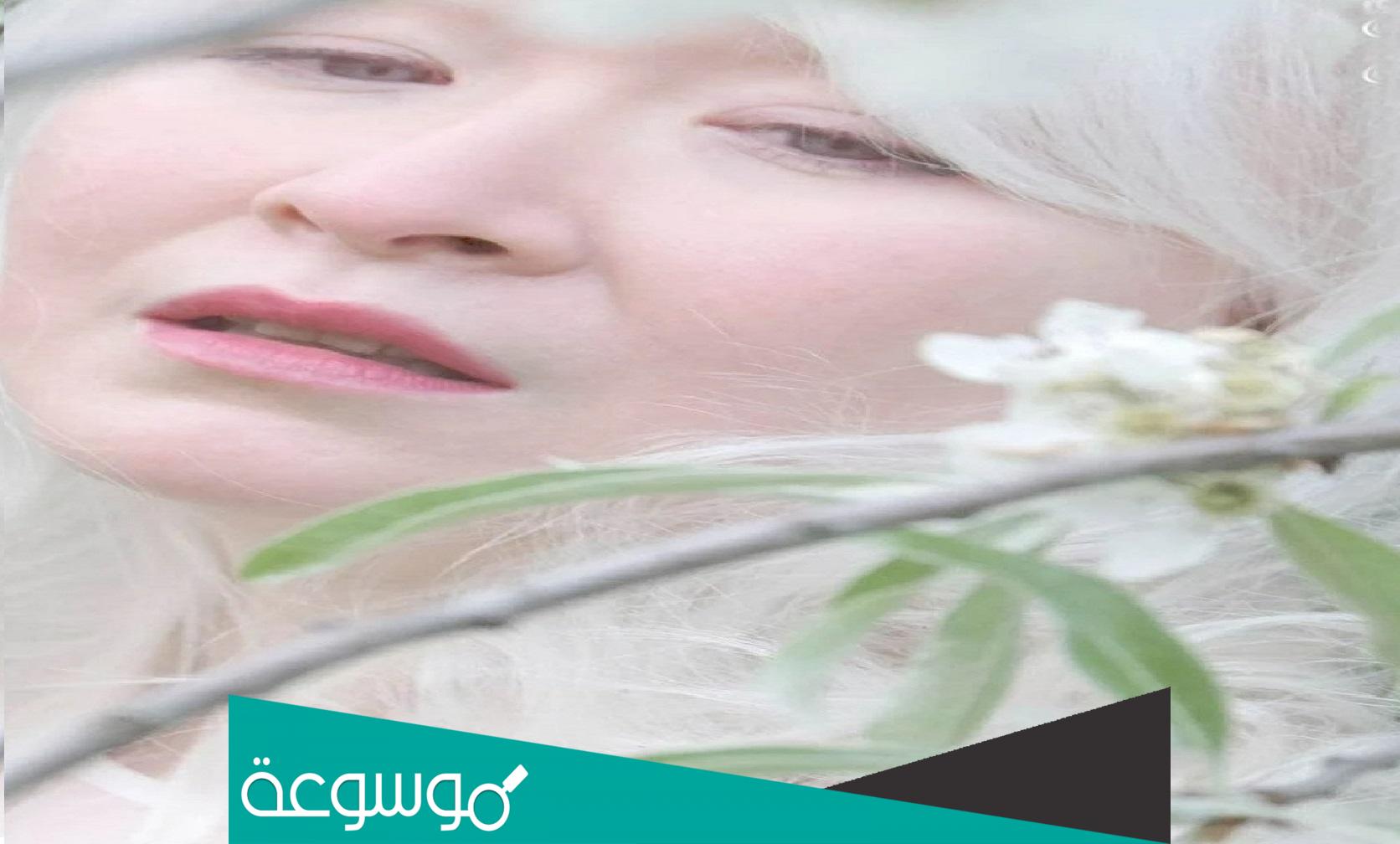 من هي صاحبة افتح بشرة بنت في العالم؟