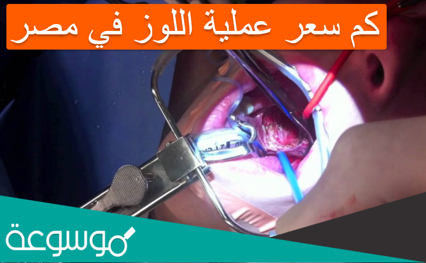 كم سعر عملية اللوز في مصر