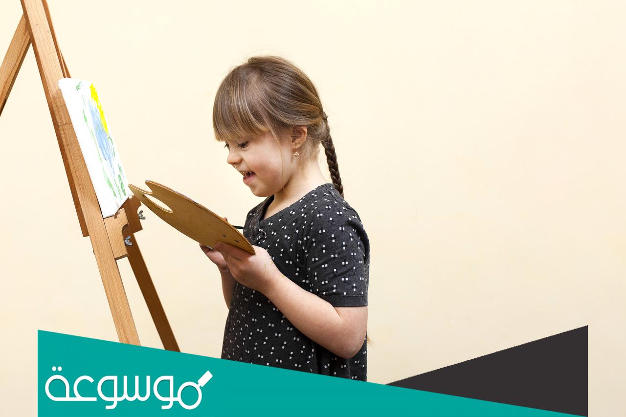 كم يعيش الطفل المصاب بمتلازمة داون