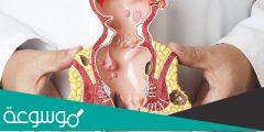 كيف اعرف ان عندي بواسير او شرخ؟