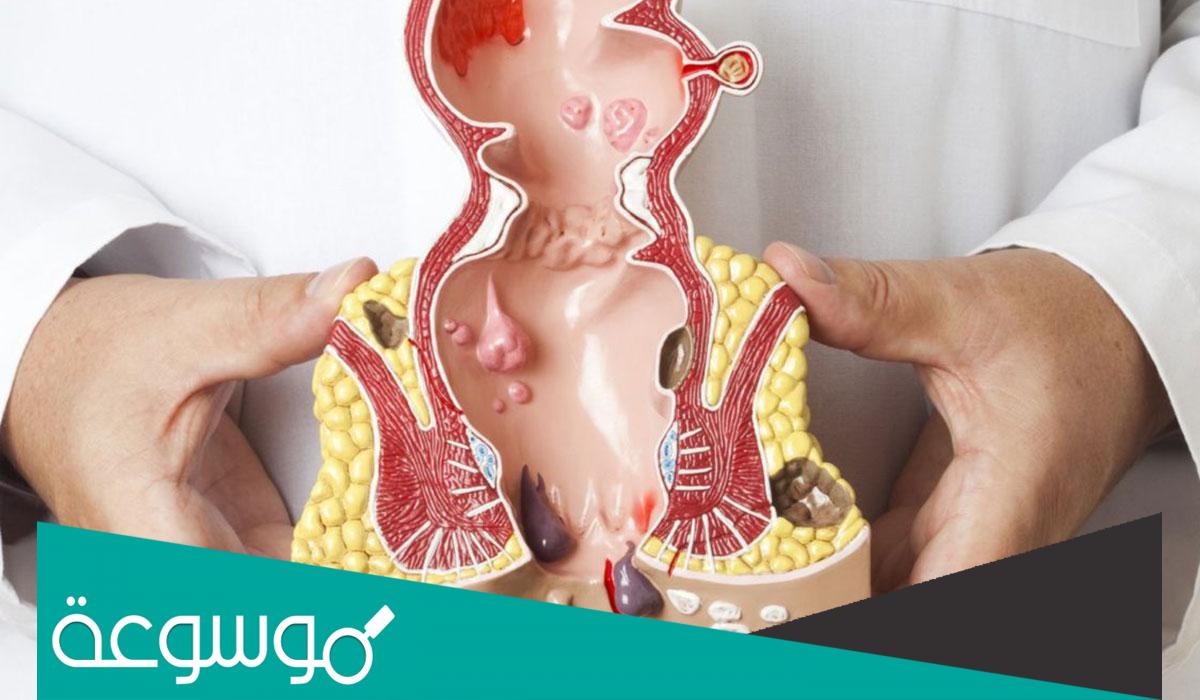 كيف اعرف ان عندي بواسير او شرخ؟