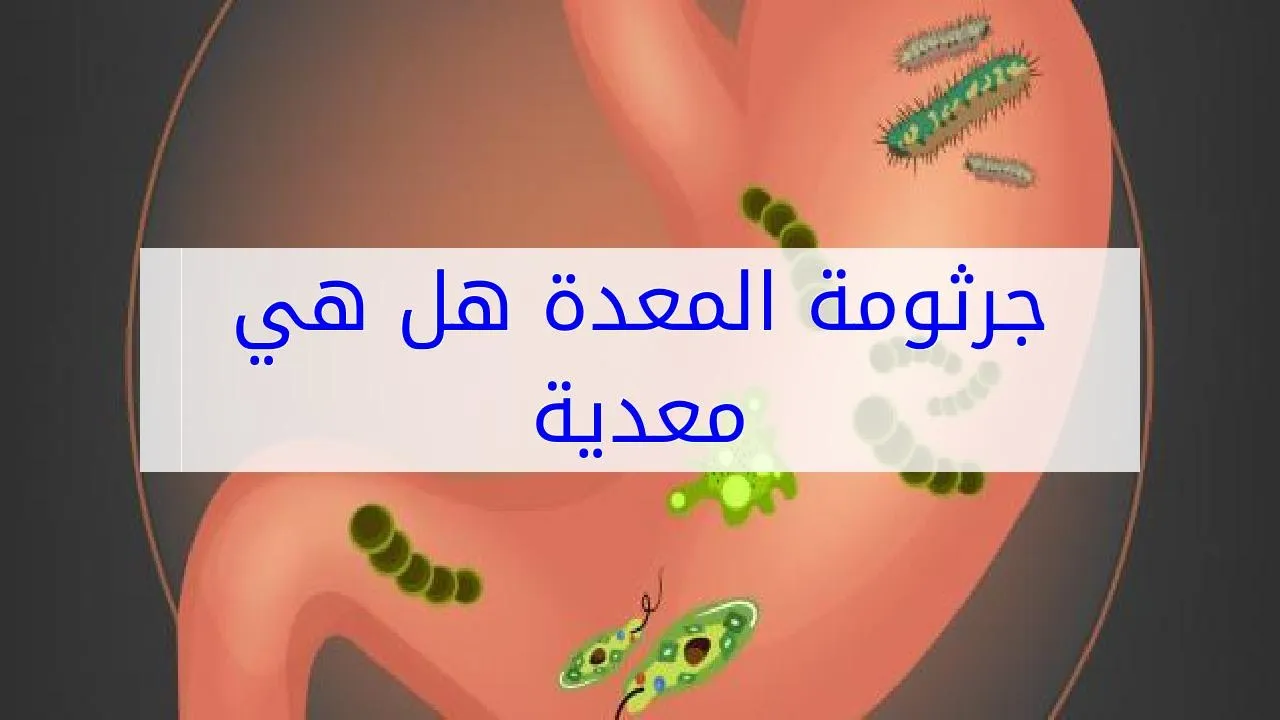 كيف تنتقل جرثوم المعدة وهل هي معدية بين الزوجين