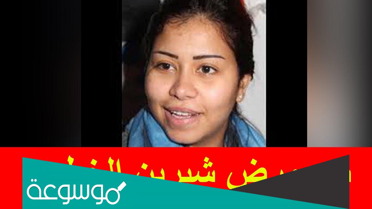 ما هو مرض شيرين عبد الوهاب