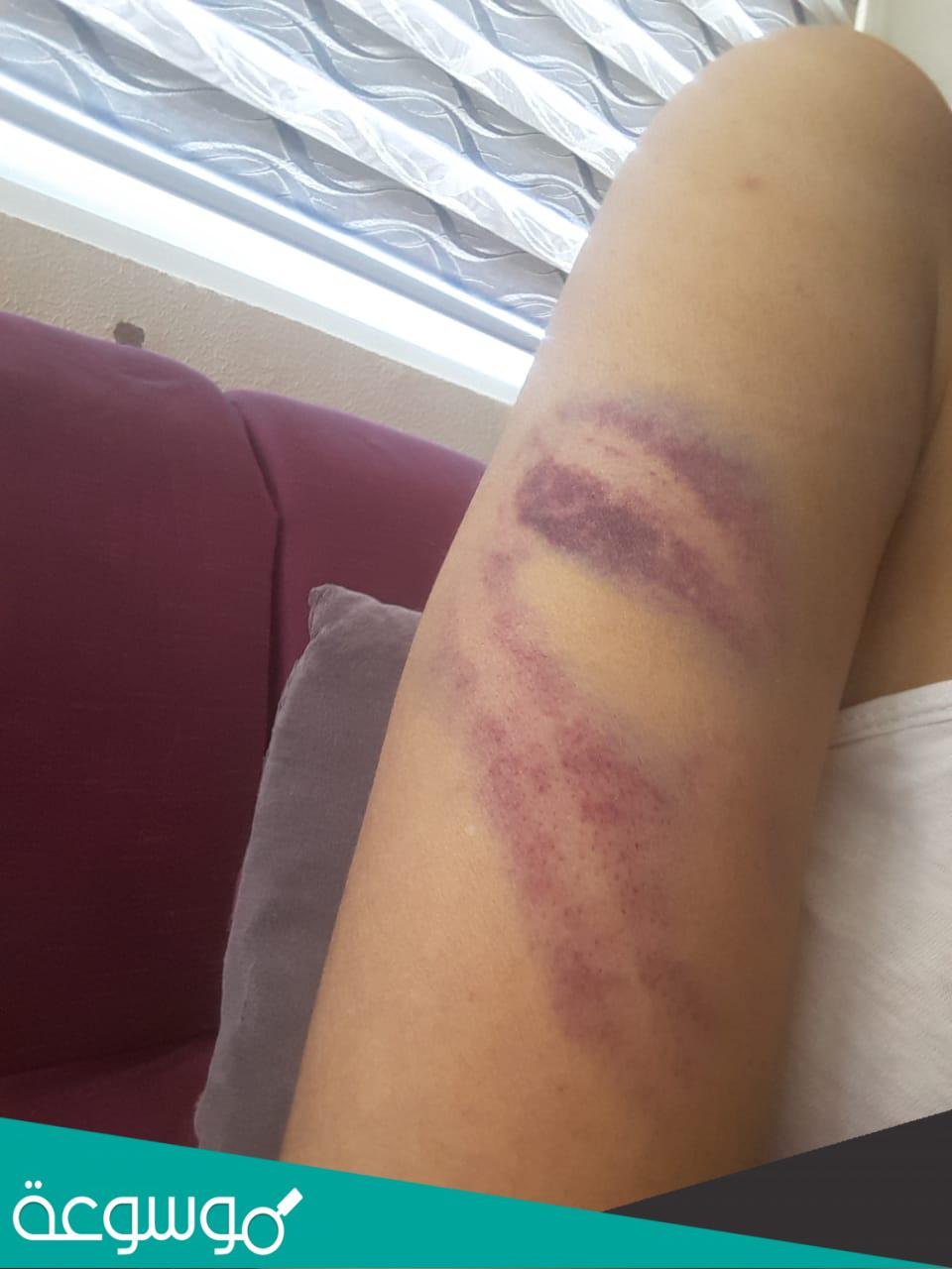 من هو زوج غنوة علاوي السيرة الذاتية