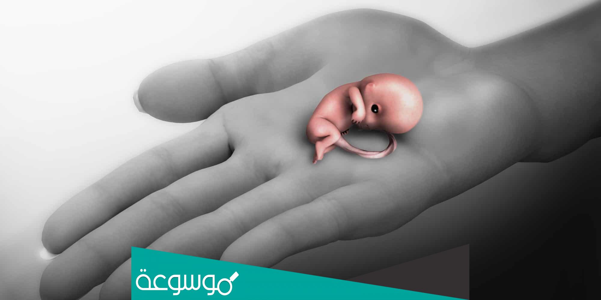 هل يجوز للمرأة الإجهاض خوفا على صحتها اسلام ويب