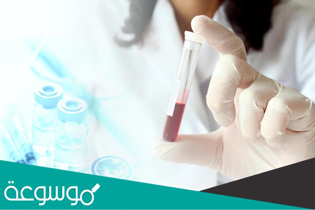 تحليل alkaline phosphatase المعدل الطبيعي للاطفال
