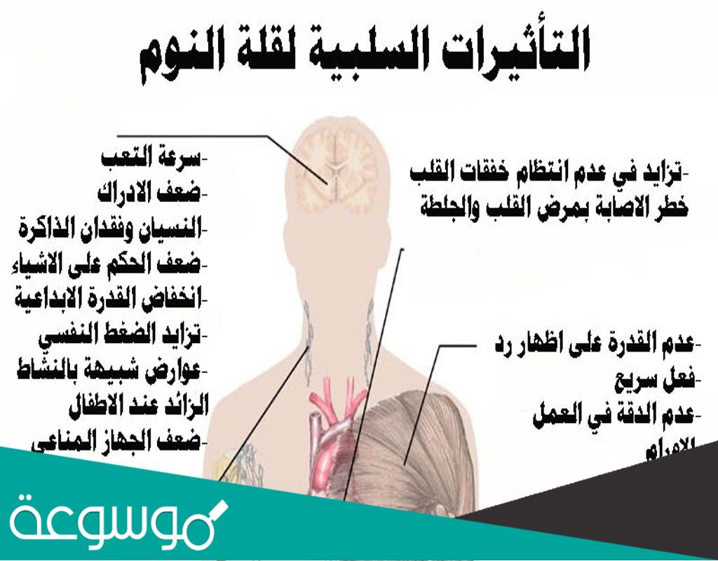 ماذا تفعل قلة النوم بالانسان؟