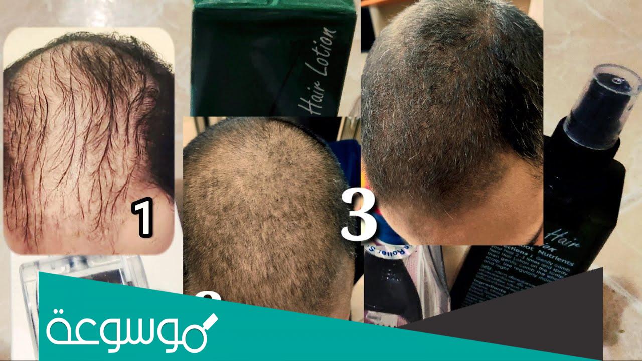 نيو هير لوشن تجارب