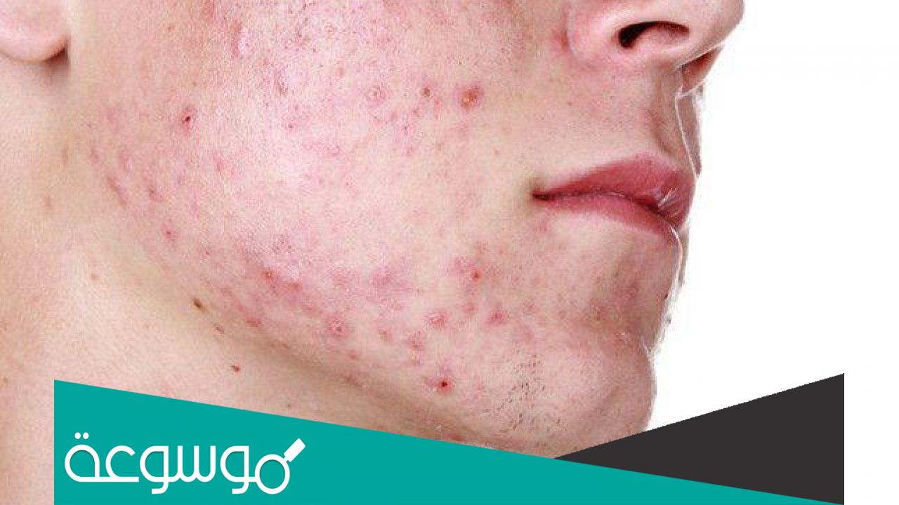 تجربتي مع كريم ماربالين