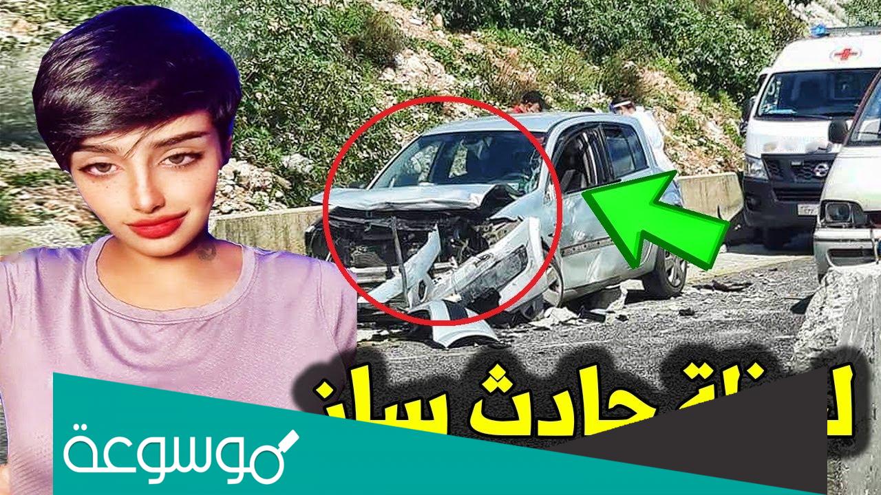 وجه ساز القحطاني بعد الحادث " صور "