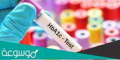 ما هو تحليل hba1c
